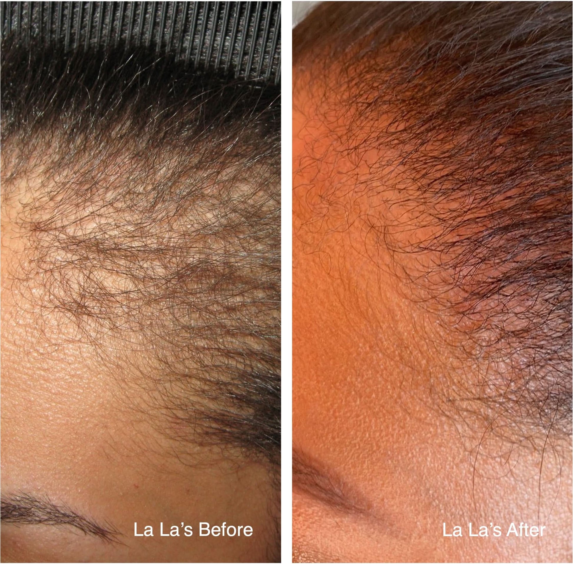 Rice Water Ritual Boost Hair Growth